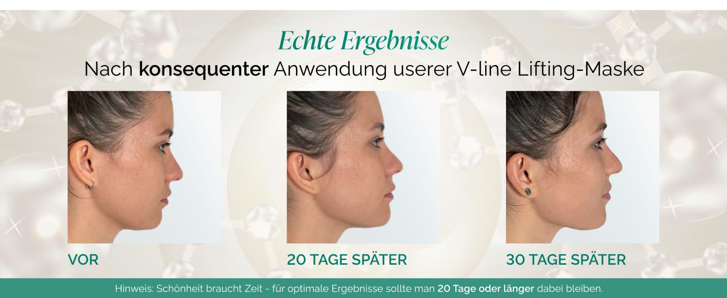 Plantifique V-Line Gesichtsmaske – 5er Set | Strafft Kinn & Jawline