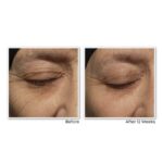 RoC RetinolCorrexion Nachtcreme – Anti-Falten & Anti-Aging mit Retinol & Mineral-Komplex – 30 ml