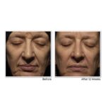 RoC RetinolCorrexion Nachtcreme – Anti-Falten & Anti-Aging mit Retinol & Mineral-Komplex – 30 ml