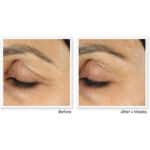 RoC - Retinol Correxion Line Smoothing Eye Cream