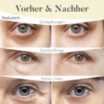 BLOOMORA Augenpads (30 Paare) – Mit Niacinamid & Hyaluron gegen Augenringe – Bild 4