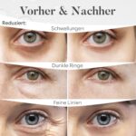Gemischte Augenpads 30 Paar – Niacinamid & Hyaluron Eye Patches gegen Augenringe