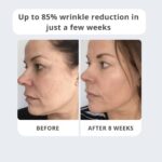 After Inject Natural Botulin Serum mit Argireline, Matrixyl & Syn-Ake – Anti-Aging Gesichtsserum gegen Falten für reife Haut – Bild 2