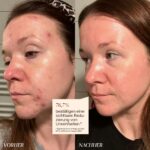 junglück Azelain Serum 10% – Vegan Gesichtsserum gegen Pickel, Rötungen & Pigmentflecken – Bild 2