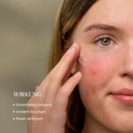 junglück Azelain Serum 10% – Vegan Gesichtsserum gegen Pickel, Rötungen & Pigmentflecken – Bild 3