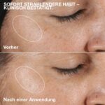 Clinique Clarifying Lotion 2 – Sanfte Peeling-Lotion für Mischhaut – Bild 6