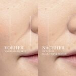 Lancôme Rénergie H.C.F. Triple Serum 50 ml – Anti-Aging Gesichtspflege mit Vitamin C & Hyaluronsäure – Bild 4
