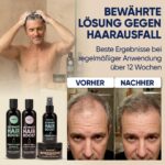 Moerie 4er-Set Haarwachstum – Shampoo, Conditioner, Serum & Maske mit 77 Mineralien – Bild 5
