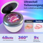 Stim-U-Dent Ultraschallreiniger 45kHz mit UV & Desodorierung für Zahnschienen – Bild 3