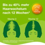 270 Stück Priorin Kapseln mit Hirseextrakt, Vitamin B5 & L-Cystin – 12-Wochen-Kur gegen Haarausfall für Frauen – Bild 11