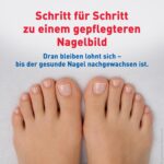 SOS Nagelpilz-Pflaster 6x8er – Medizinprodukt zur Intensiv-Behandlung über Nacht – Bild 5