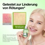 ANUA Azelaic Acid 10 Serum mit Hyaluron – Beruhigendes Gesichtsserum für unreine Haut – Bild 6