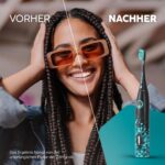 happybrush Eco Vibe 3 Schallzahnbürste – Testsieger mit 40.000 Vibrationen & 8 Wochen Akku – Bild 7