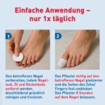 SOS Nagelpilz-Pflaster 6x8er – Medizinprodukt zur Intensiv-Behandlung über Nacht – Bild 4