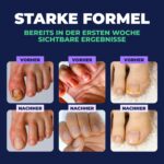 Orivelle Nail Care Pen – Kosmetischer Nagelpflegestift für Nägel & Nagelhaut – 4er-Pack für die tägliche Pflegeroutine – Bild 7