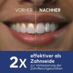 Waterpik Professional Water Flosser – Munddusche mit Precision Pulse Technology für optimale Zahnfleischschutz – Bild 3