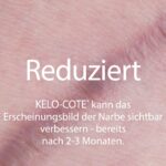 KELO-COTE UV SPF30 Silikon-Narbengel 15g – Narbenbehandlung mit Sonnenschutz – Bild 3