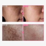 50ml TOSOWOONG Arbutin 7% & Tranexamsäure 4% Creme mit Niacinamid & Glutathion – gegen Pigmentflecken für alle Hauttypen – Bild 2