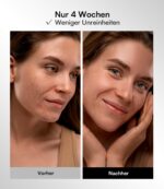 INIA LED Gesichtsmaske mit 4 Modi & 850 nm NIR – Rotlichttherapie für Anti-Aging – Bild 6