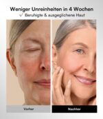 INIA LED Gesichtsmaske mit 4 Modi & 850 nm NIR – Rotlichttherapie für Anti-Aging – Bild 5