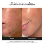 118 ml Paula's Choice Skin Perfecting 2% BHA Liquid Peeling mit Salicylsäure – Porenreinigendes Gesichtspeeling für Mischhaut & fettige Haut – Bild 5