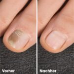 IZA Effect Fussraum-Pflegespray 2x100ml – Tägliche Fusshygiene & Nagelpflege – Bild 5