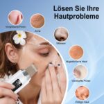 Yeerain Ultraschall-Porenreiniger mit 4 Modi & rotem/blauem Licht – Gesichtsreinigungsgerät – Bild 6