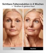 INIA LED Gesichtsmaske mit 4 Modi & 850 nm NIR – Rotlichttherapie für Anti-Aging – Bild 4