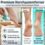 Grundig Hornhautentferner Pro – Elektrischer Fussspflege-Entferner mit LED & Akku – Bild 3