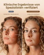 RENPHO LED-Gesichtsmaske mit 324 LED-Chips – Professionelle Lichttherapie für Zuhause – Bild 4