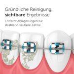 WonderSmile Munddusche PRO – Testsieger 2026 mit SmoothFlow-Technologie & 30 Tage Akkulaufzeit – Bild 9