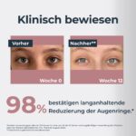 Eucerin Anti-Pigment Augencreme 15 ml – Augenringe & Schwellungen reduzieren – Bild 3