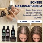 Moerie 4er-Set Haarwachstum – Shampoo, Conditioner, Serum & Maske mit 77 Mineralien – Bild 4