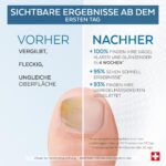 PODERM Nagelpflege-Serum mit pflanzlichen Ölen – Intensivpflege für verfärbte Nägel – Bild 3