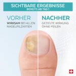 PODERM Nagelpilz-Serum – Professionelle Behandlung für Fuss- & Fingernägel | Swiss Made – Bild 3