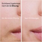 Braun Silk·expert Pro 5 IPL-Haarentfernungsgerät – Dauerhafte Haarentfernung für Zuhause – Bild 3
