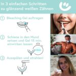 UniqueSmile Teeth Whitening Kit – Zahnaufhellung mit LED & Gelformel für strahlend weisse Zähne – Bild 3