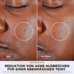 Shark CryoGlow LED-Gesichtsmaske – Lichttherapie mit Augenkühlung & Fernbedienung – Bild 10