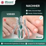 Blizzard Podologie Instrumente Set – 5-teiliges Profi Fussplege Werkzeug für eingewachsene Nägel – Bild 5