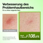 ANUA Azelaic Acid 10 Serum mit Hyaluron – Beruhigendes Gesichtsserum für unreine Haut – Bild 5
