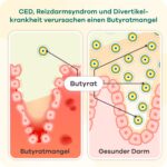 Butyzol Natriumbutyrat 60 Kapseln – Klinisch getestetes Darmmanagement für entzündliche Erkrankungen – Bild 4