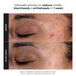 118 ml Paula's Choice Skin Perfecting 2% BHA Liquid Peeling mit Salicylsäure – Porenreinigendes Gesichtspeeling für Mischhaut & fettige Haut – Bild 7