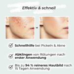 VIGOROUS® Zinksalbe 60ml gegen Pickel – Anti-Akne Creme mit Teebaumöl & Salicylssäure – Bild 2
