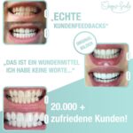 UniqueSmile Teeth Whitening Kit – Zahnaufhellung mit LED & Gelformel für strahlend weisse Zähne – Bild 2