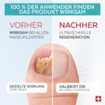 PODERM 2-in-1 Nagelpilz-Behandlung Duo-Pack – Mycose-Serum & Booster für gelbe, brüchige Fussnägel – Bild 3