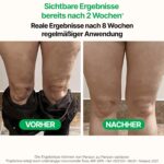 TESMED CELLULITE Manueller Anti-Cellulite Massageroller mit patentierter Rollentechnologie – Made in Italy für Oberschenkel & Gesäss – Bild 4