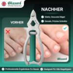 Blizzard Fussnagelzange 15 cm mit Pufferfeder – Profi Edelstahl Pediküre Werkzeug für dicke Nägel – Bild 5
