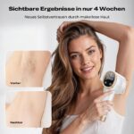 Beauris IPL Haarentfernungsgerät mit 8°C Eiskühlung & 21J – Profi-Laser für Frauen & Männer – Bild 6