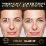 L'Oréal Paris Age Perfect Zell-Renaissance Set – Anti-Aging Tag- & Nachtcreme mit Vitamin E – Bild 5